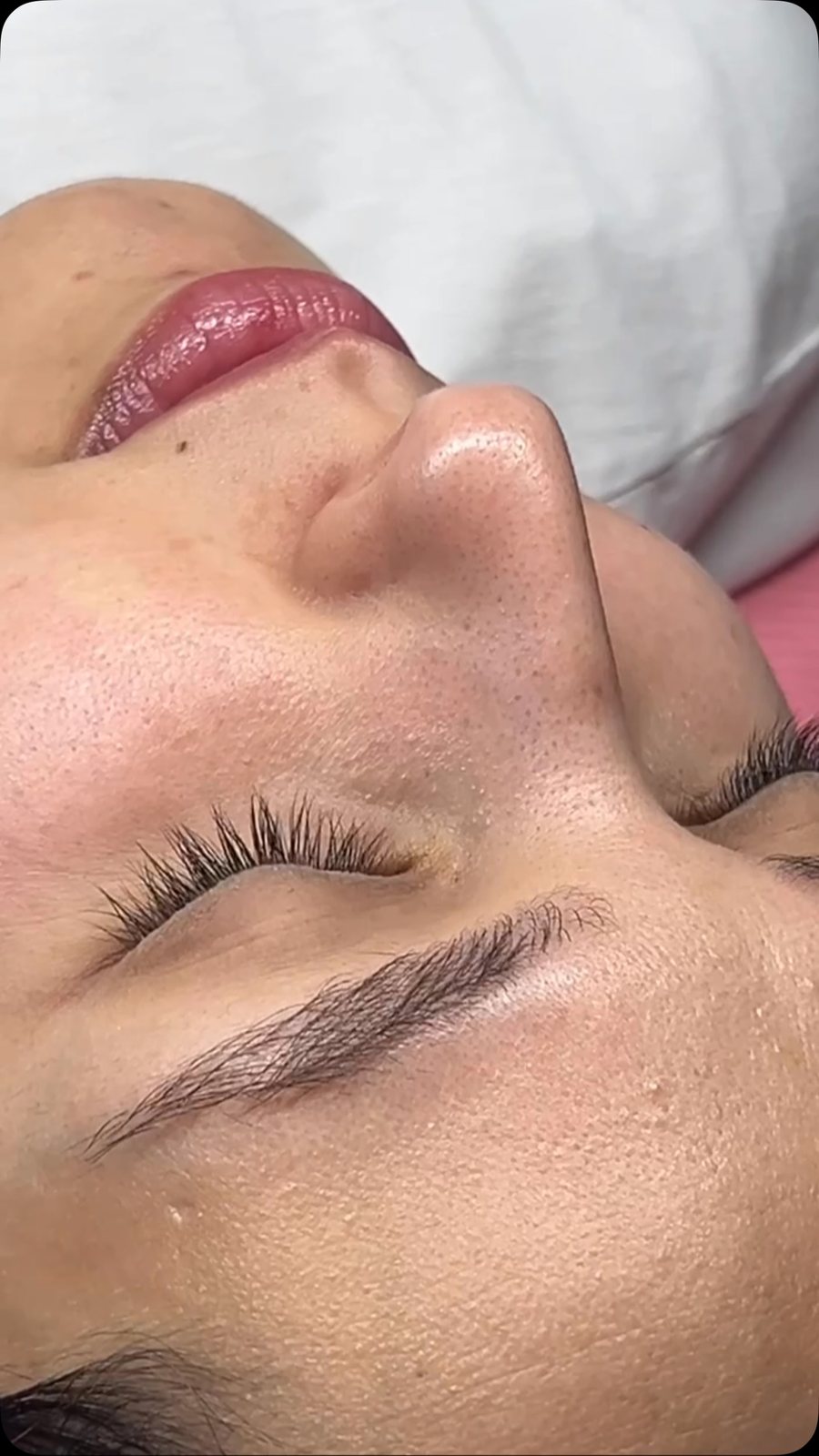 Client result from Skin Care by Eman Khaled