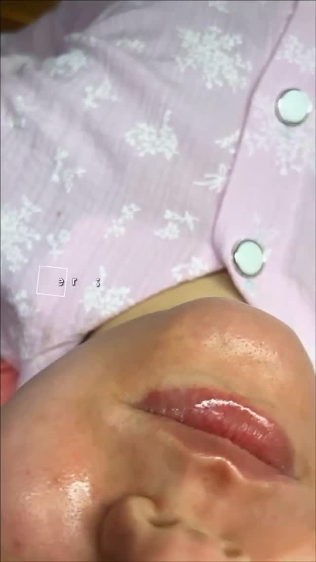 Client result from Skin Care by Eman Khaled