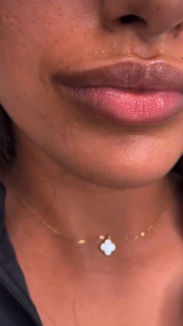 Lip lightening result