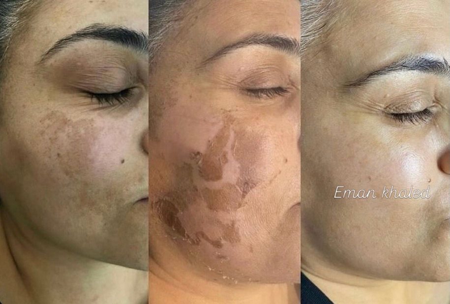 Client result from Skin Care by Eman Khaled